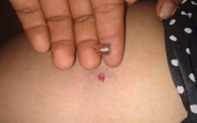 UNA MUJER FUE VÍCTIMA DE UNA BALA PERDIDA EN FUSAGASUGÁ